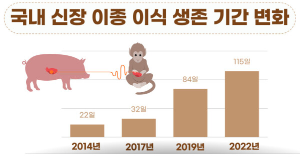 신장 이종이식 생존기간 변화